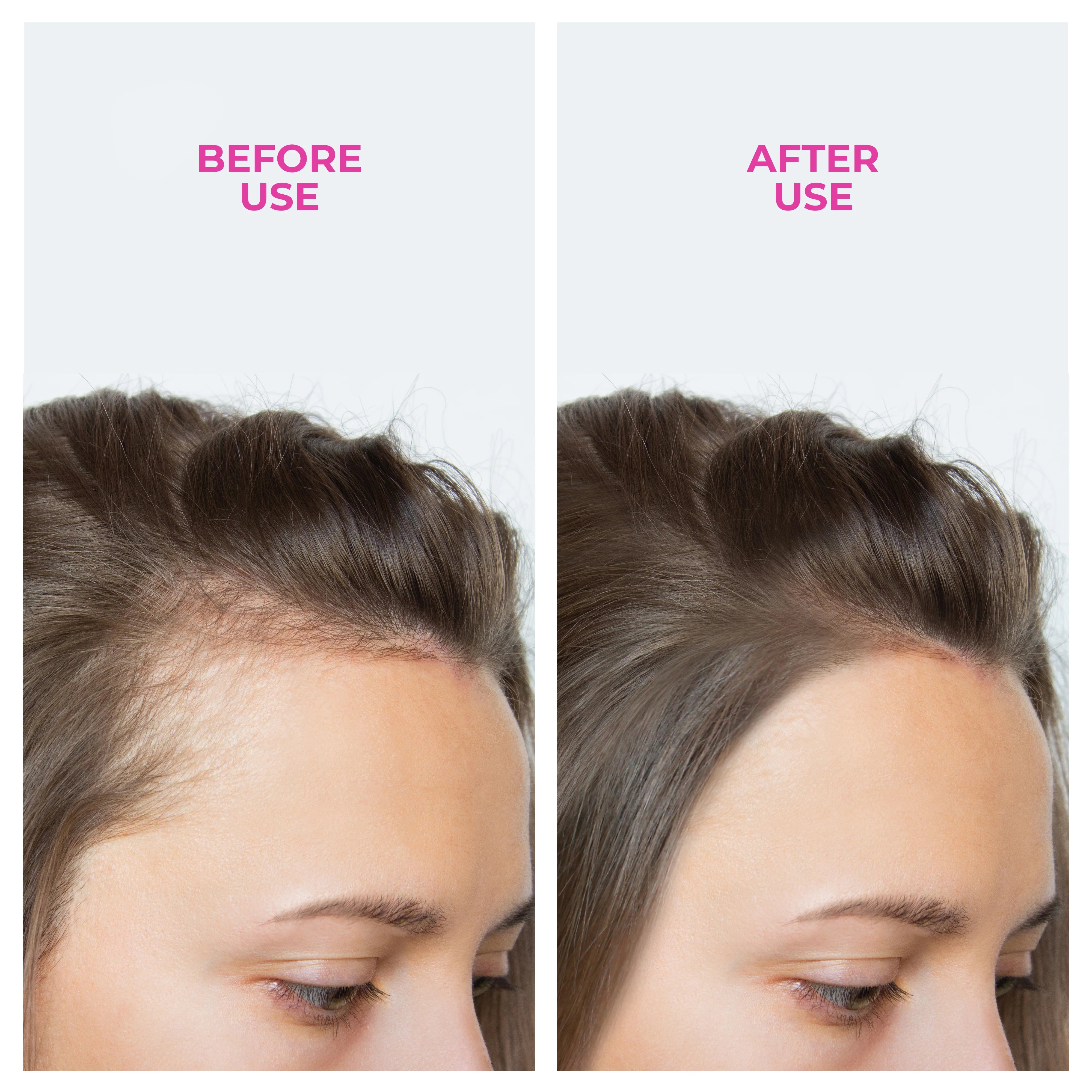 Kit Anticadere Păr Framesi: Șampon Densifiant + Spray Energizant - Rezultate Rapide - Coafor Bucuresti